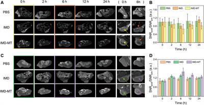 Developing Smart Nanoparticles Responsive to the Tumor Micro-Environment for Enhanced Synergism of Thermo-Chemotherapy With PA/MR Bimodal Imaging